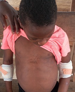 Enfant victime de maltraitance